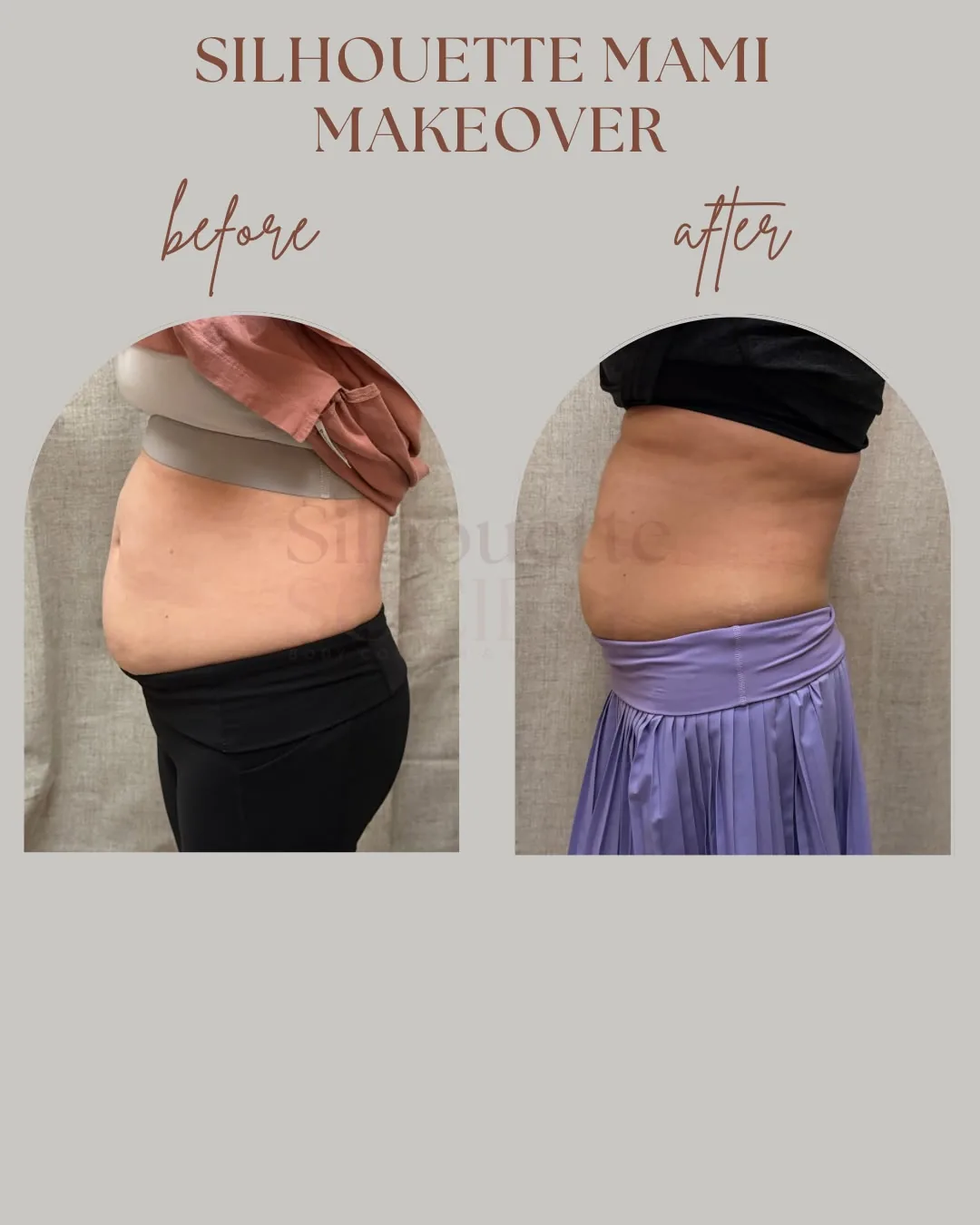 Silhouette Mami Makeover before and after, client two
